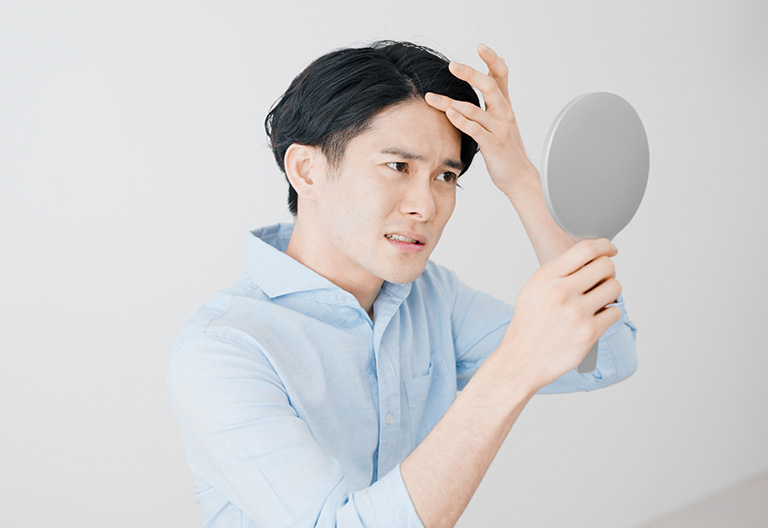 男性型脱毛症(AGA)とは